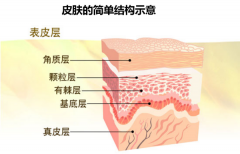 水杨酸用于护肤有哪些功效？